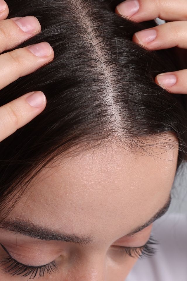 Quel shampooing est le plus efficace contre les pellicules ?